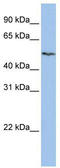Solute Carrier Family 16 Member 6 antibody, TA333963, Origene, Western Blot image 