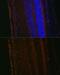 Lysyl Oxidase Like 1 antibody, GTX64529, GeneTex, Immunohistochemistry paraffin image 