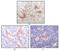 FES Proto-Oncogene, Tyrosine Kinase antibody, NBP1-28880, Novus Biologicals, Immunohistochemistry paraffin image 