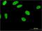 Zinc Finger Protein 35 antibody, H00007584-M03, Novus Biologicals, Immunocytochemistry image 