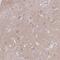 Transgelin 3 antibody, NBP2-37995, Novus Biologicals, Immunohistochemistry frozen image 