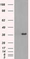 Tribbles Pseudokinase 2 antibody, TA500510, Origene, Western Blot image 