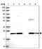 Neuropeptide VF Precursor antibody, NBP1-86724, Novus Biologicals, Western Blot image 