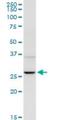 Uroporphyrinogen III Synthase antibody, H00007390-D01P, Novus Biologicals, Western Blot image 