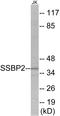 Single Stranded DNA Binding Protein 2 antibody, EKC1765, Boster Biological Technology, Western Blot image 