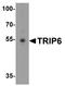 Thyroid Hormone Receptor Interactor 6 antibody, A04275, Boster Biological Technology, Western Blot image 
