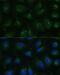 Coatomer Protein Complex Subunit Gamma 2 antibody, 16-251, ProSci, Immunofluorescence image 