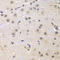 Cyclin G1 antibody, LS-C346078, Lifespan Biosciences, Immunohistochemistry paraffin image 