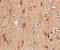 SLIT And NTRK Like Family Member 3 antibody, A14176, Boster Biological Technology, Immunohistochemistry paraffin image 