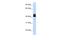 G Protein Subunit Alpha 15 antibody, A09290, Boster Biological Technology, Western Blot image 