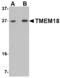 Transmembrane Protein 18 antibody, MBS151130, MyBioSource, Western Blot image 