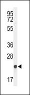 Gamma-Glutamylcyclotransferase antibody, LS-B10553, Lifespan Biosciences, Western Blot image 