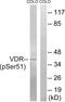 Vitamin D Receptor antibody, abx012636, Abbexa, Western Blot image 