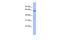 Plastin 1 antibody, GTX45058, GeneTex, Western Blot image 