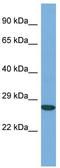 Actin Like 6A antibody, TA345058, Origene, Western Blot image 