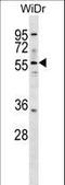 Asparagine Synthetase (Glutamine-Hydrolyzing) antibody, LS-C156545, Lifespan Biosciences, Western Blot image 