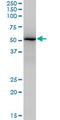 Zinc Finger And SCAN Domain Containing 18 antibody, MA5-22540, Invitrogen Antibodies, Western Blot image 
