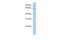 GATA Zinc Finger Domain Containing 2B antibody, GTX48952, GeneTex, Western Blot image 