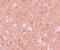 Tripartite Motif Containing 71 antibody, PA5-21011, Invitrogen Antibodies, Immunohistochemistry paraffin image 