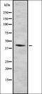 Farnesyltransferase, CAAX Box, Alpha antibody, orb337054, Biorbyt, Western Blot image 
