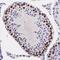 Synaptonemal Complex Protein 3 antibody, GTX15091, GeneTex, Immunohistochemistry paraffin image 