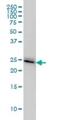 Platelet Activating Factor Acetylhydrolase 1b Catalytic Subunit 3 antibody, H00005050-M02, Novus Biologicals, Western Blot image 