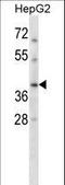 RAD51 Paralog C antibody, LS-C162411, Lifespan Biosciences, Western Blot image 