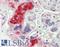 Proteoglycan 2, Pro Eosinophil Major Basic Protein antibody, LS-B12902, Lifespan Biosciences, Immunohistochemistry paraffin image 