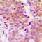 Ribosomal Protein S6 Kinase B1 antibody, LS-C352830, Lifespan Biosciences, Immunohistochemistry frozen image 