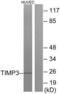 TIMP Metallopeptidase Inhibitor 3 antibody, LS-C118597, Lifespan Biosciences, Western Blot image 