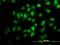 EH Domain Containing 2 antibody, H00030846-M01, Novus Biologicals, Immunocytochemistry image 