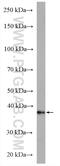 Ceramide Kinase antibody, 25731-1-AP, Proteintech Group, Western Blot image 