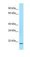 Crystallin Alpha B antibody, orb330536, Biorbyt, Western Blot image 