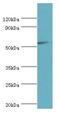 Interferon Gamma Receptor 1 antibody, LS-C375948, Lifespan Biosciences, Western Blot image 