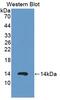 S100 Calcium Binding Protein A12 antibody, abx129972, Abbexa, Enzyme Linked Immunosorbent Assay image 