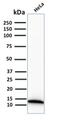 S100 Calcium Binding Protein A4 antibody, GTX02703, GeneTex, Western Blot image 