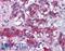 MER Proto-Oncogene, Tyrosine Kinase antibody, LS-B4445, Lifespan Biosciences, Immunohistochemistry frozen image 