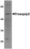 TBK1 Binding Protein 1 antibody, PA5-20814, Invitrogen Antibodies, Western Blot image 