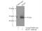 IKAROS Family Zinc Finger 5 antibody, 24780-1-AP, Proteintech Group, Immunoprecipitation image 