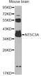 5'-Nucleotidase, Cytosolic IIIA antibody, LS-C749140, Lifespan Biosciences, Western Blot image 