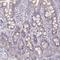 Centromere Protein H antibody, HPA036494, Atlas Antibodies, Immunohistochemistry paraffin image 