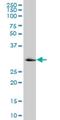 Ketohexokinase antibody, H00003795-M07, Novus Biologicals, Western Blot image 