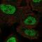 Msh Homeobox 1 antibody, NBP2-57021, Novus Biologicals, Immunocytochemistry image 