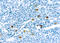 Chymase 1 antibody, GTX72388, GeneTex, Immunohistochemistry paraffin image 
