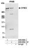 Spectrin Repeat Containing Nuclear Envelope Protein 2 antibody, A305-393A, Bethyl Labs, Immunoprecipitation image 