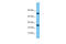 RAS Related 2 antibody, ARP54549_P050, Aviva Systems Biology, Western Blot image 