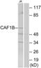 Chromatin Assembly Factor 1 Subunit B antibody, LS-C119007, Lifespan Biosciences, Western Blot image 