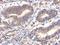 Fucose-1-Phosphate Guanylyltransferase antibody, NBP2-16527, Novus Biologicals, Immunohistochemistry paraffin image 