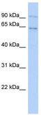 Zinc Finger Protein 319 antibody, TA339742, Origene, Western Blot image 