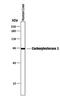 Carboxylesterase 1 antibody, MA5-24244, Invitrogen Antibodies, Western Blot image 